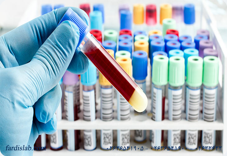 مزایا و معایب آزمایشهای غربالگری سرطان مزایا و معایب آزمایشهای غربالگری سرطان