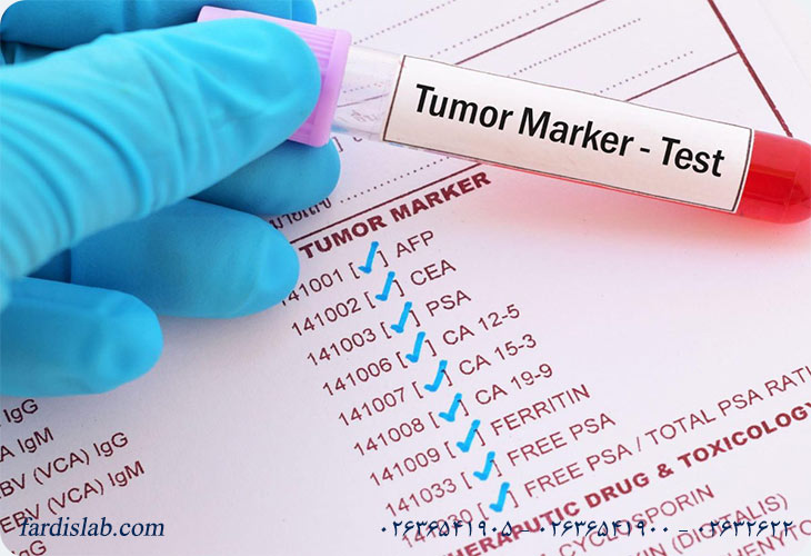 نشانگرهای تومور در آزمایش خون چیست نشانگرهای تومور در آزمایش خون چیست