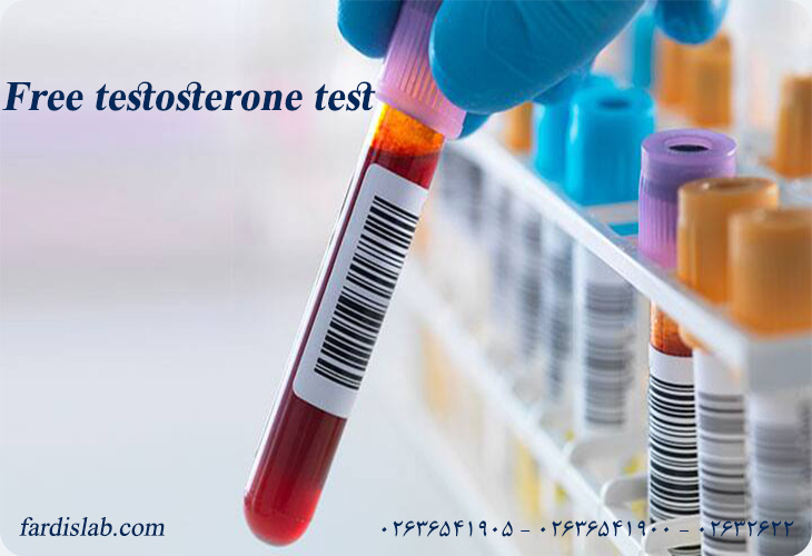 آزمایش free testosterone چیست؟