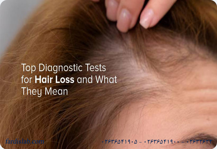 تفسیر نتایج آزمایش ریزش مو به زبان ساده تفسیر نتایج آزمایش ریزش مو به زبان ساده