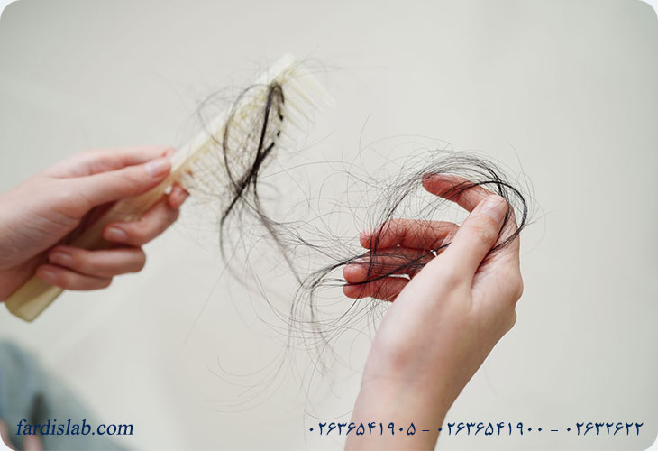 علت اصلی ریزش مو در زنان و مردان