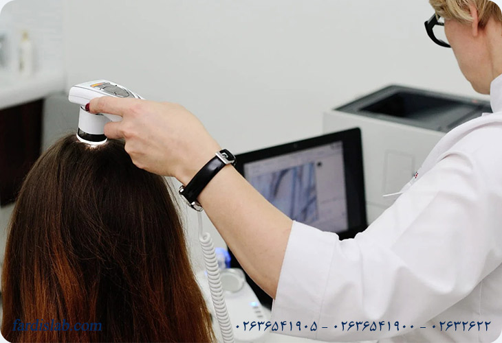 چه زمانی انجام آزمایش برای ریزش مو ضروری است؟