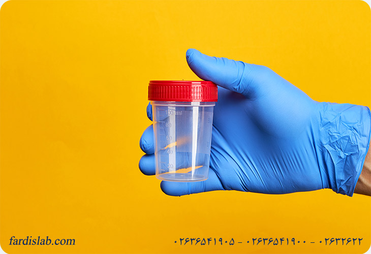 شرایط و نکات مهم قبل از انجام آزمایش مدفوع