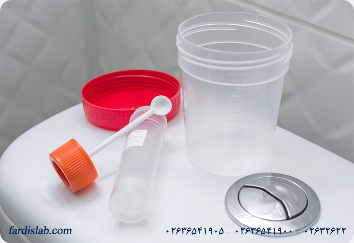 آزمایش Stool Exam  چرا انجام می‌شود؟