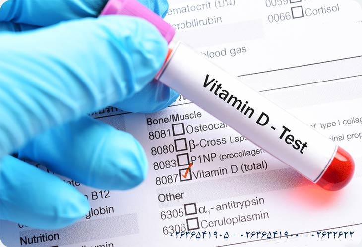 چرا آزمایش Vit D۳ درخواست می‌شود؟