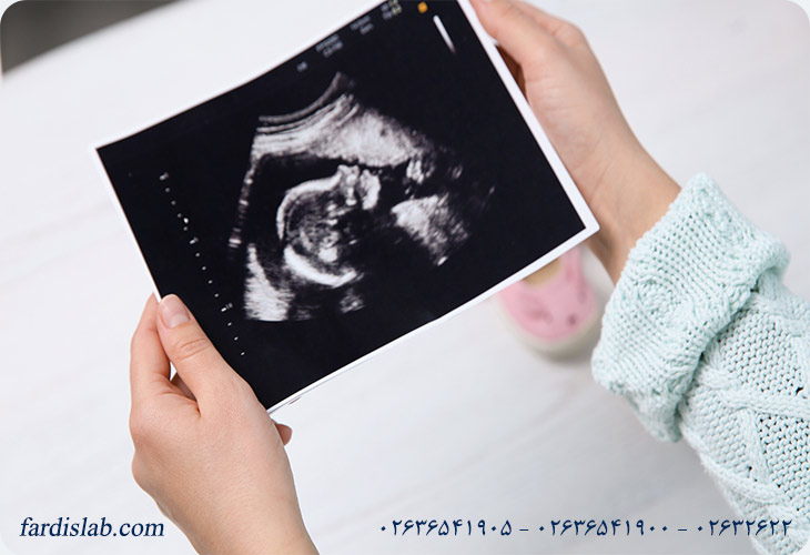 جواب آزمایش PND در بارداری
