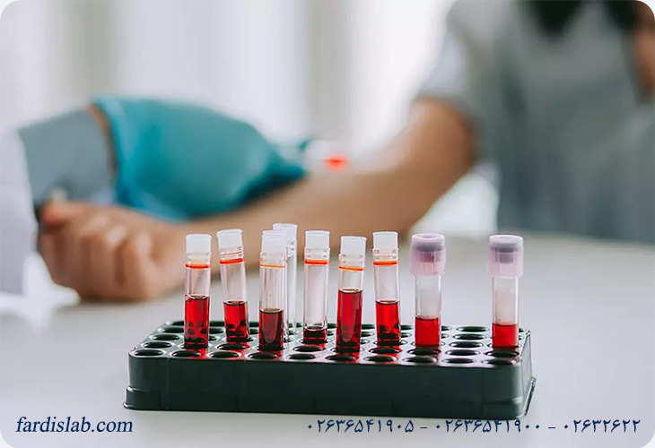چه زمانی باید آزمایش کورتیزول انجام دهیم؟ چه زمانی باید آزمایش کورتیزول انجام دهیم؟