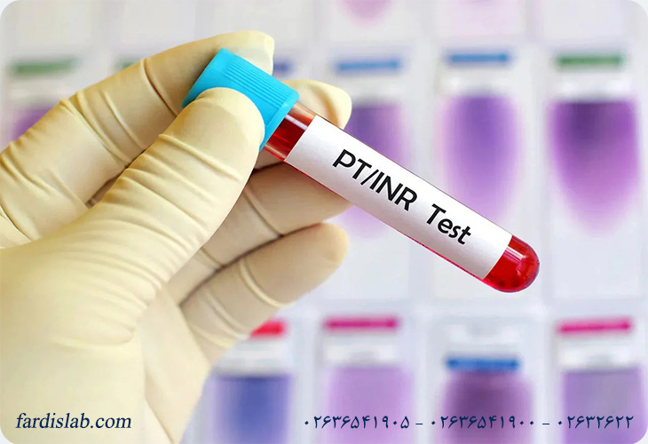 آزمایش پروترومبین(PT) چیست 