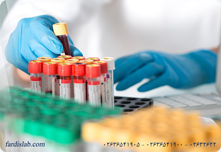 عوامل مؤثر بر دقت آزمایش ACTH عوامل مؤثر بر دقت آزمایش ACTH