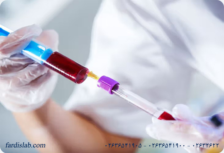 مراحل انجام آزمایش ACTH  مراحل انجام آزمایش ACTH