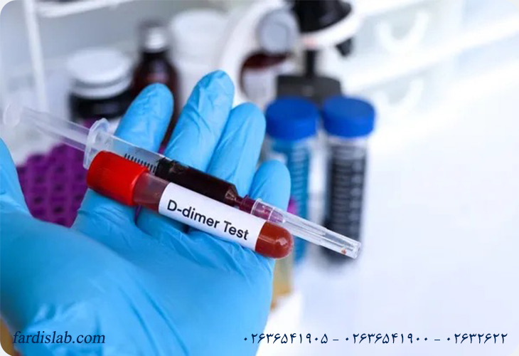 نحوه تشخیص آمبولی ریه؛ آزمایش های مورد نیاز نحوه تشخیص آمبولی ریه؛ آزمایش های مورد نیاز