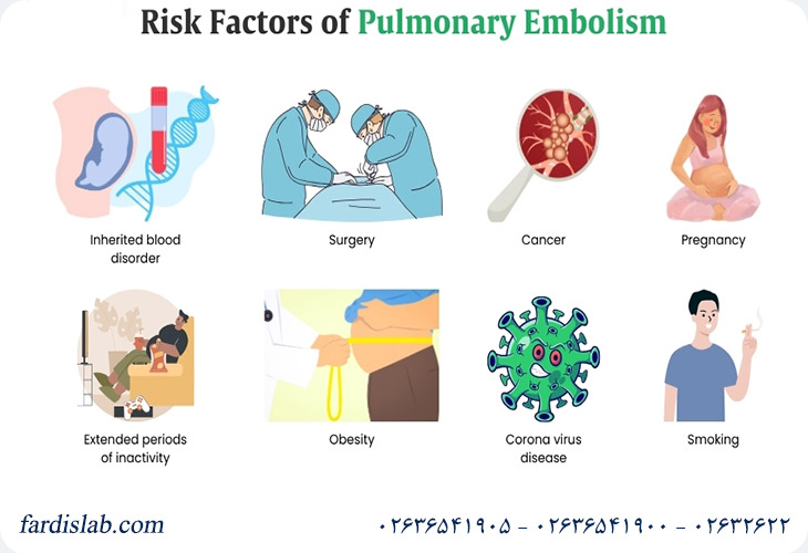 چه کسانی در معرض خطر ابتلا به آمبولی ریه هستند؟ چه کسانی در معرض خطر ابتلا به آمبولی ریه هستند؟