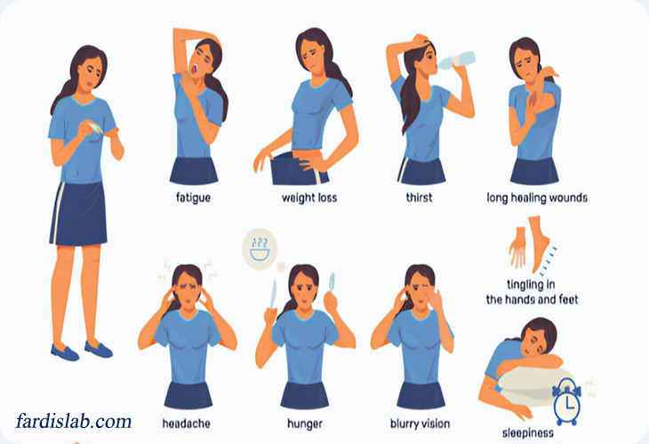 علائم دیابت در زنان مبتلا به سندرم تخمدان پلیکیستیک علائم دیابت در زنان مبتلا به سندرم تخمدان پلیکیستیک