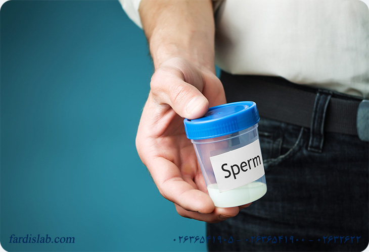 چگونه می‌توان نمونه اسپرم را تهیه نمود؟
