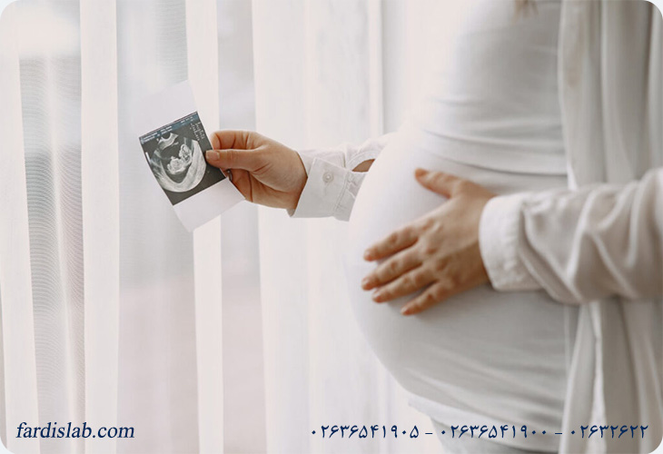 آزمایش بیلی روبین در بارداری
