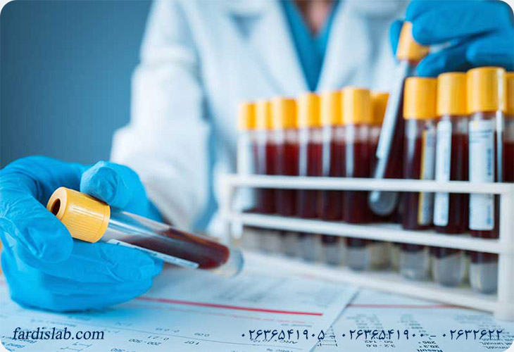 نحوه و روش انجام آزمایش بیلی روبین چگونه است؟