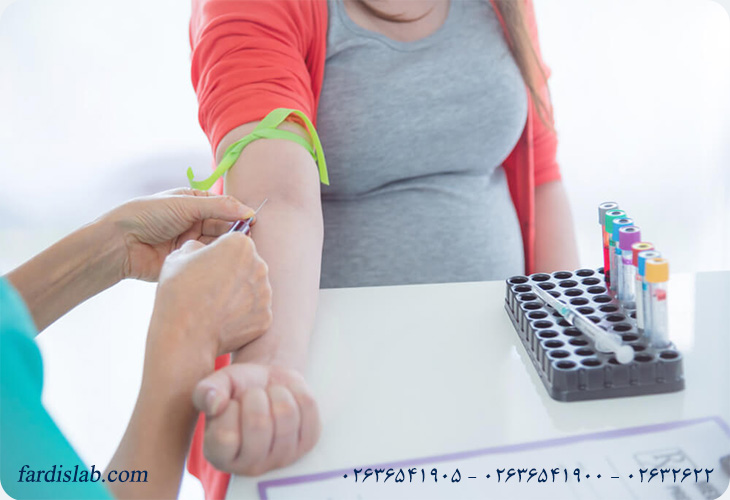 ضرورت انجام آزمایش Bilirubin در بارداری