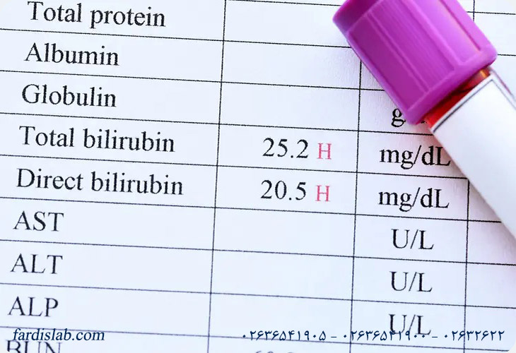 Bilirubin Direct در آزمایش خون چیست؟