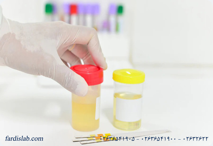 Is urine cytology testing reliable in diagnosing cancer?