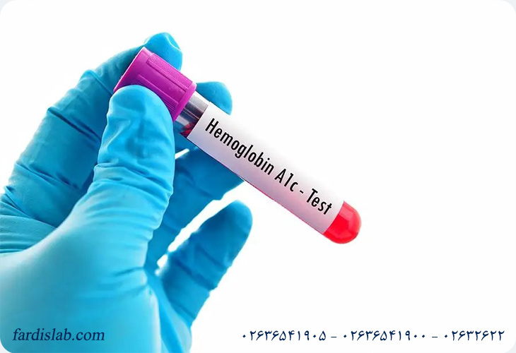 علت تجویز آزمایش HBA1C