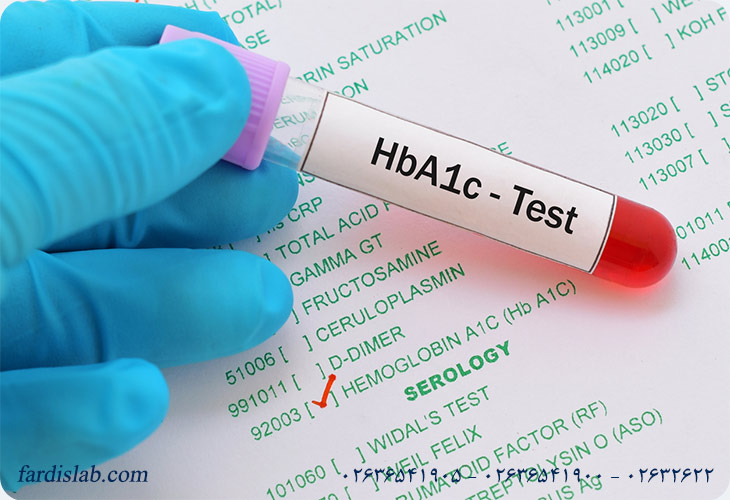 تست‌های مرتبط با آزمایش HBA1C 