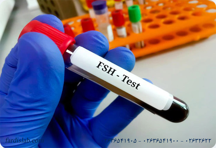 آزمایش fsh