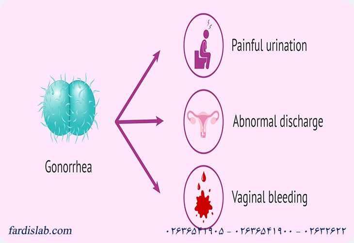 سوزاک چگونه منتقل میشود؟ سوزاک چگونه منتقل میشود؟