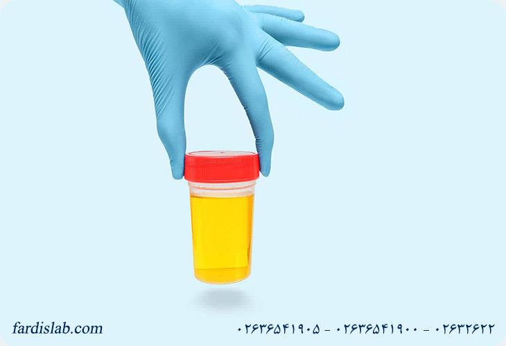 نمونه‌های لازم و آزمایش‌های تشخیص سوزاک