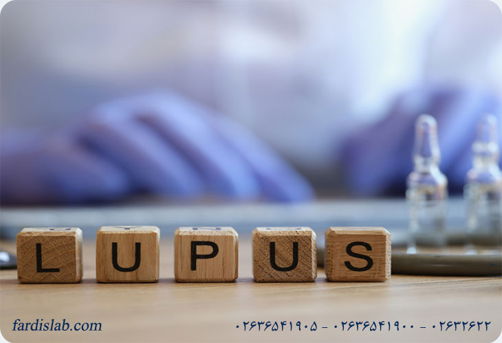 علت بروز بیماری لوپوس و عوامل مؤثر در ابتلا