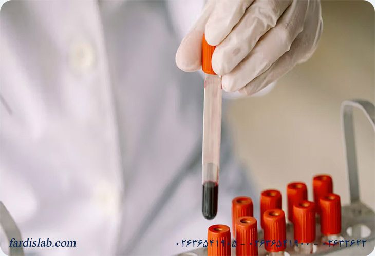 روش‌های تشخیص بیماری لوپوس