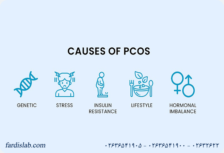 علت‌های هورمونی سندرم تخمدان پلی کیستیک