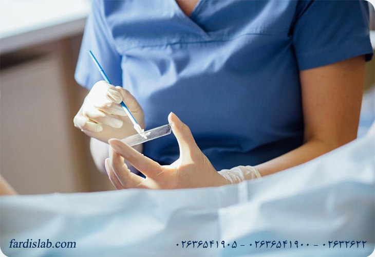 تست پاپ اسمیر تست پاپ اسمیر