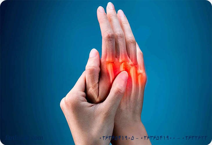  علائم روماتیسم دست چیست؟ 