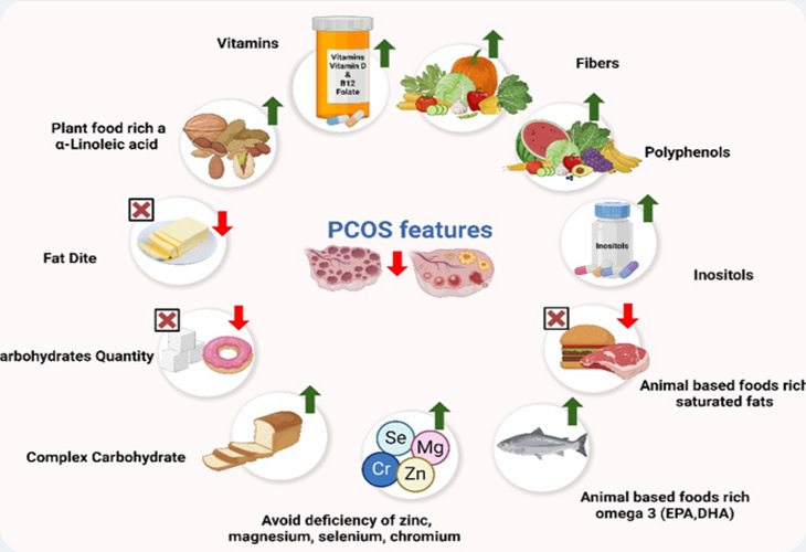 لبنیات در رژیم غذایی تخمدان پلی‌کیستیک(PCOS)