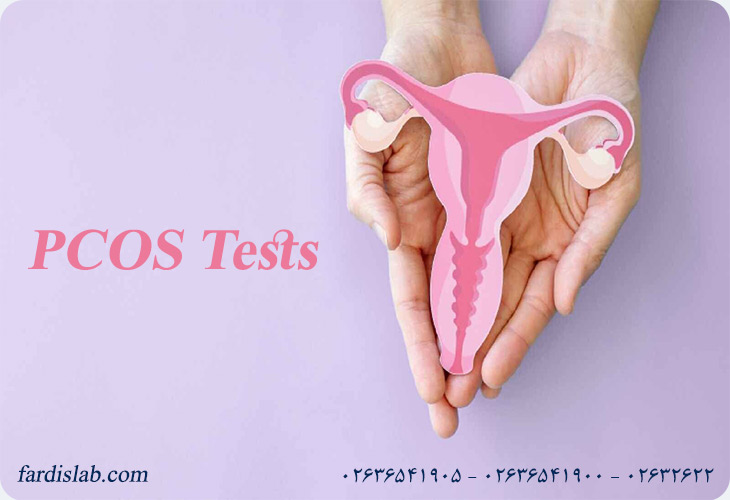 آزمایش های لازم برای تشخیص سندرم تخمدان پلی کیستیک