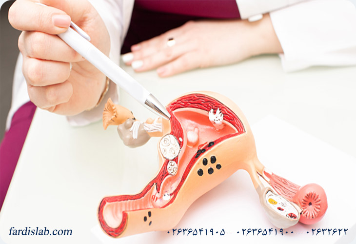 علت ابتلا به سرطان رحم و عوامل زمینه‌ساز آن