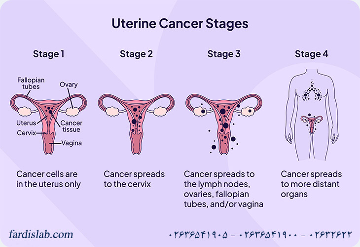تفاوت‌های اصلی بین انواع سرطان رحم