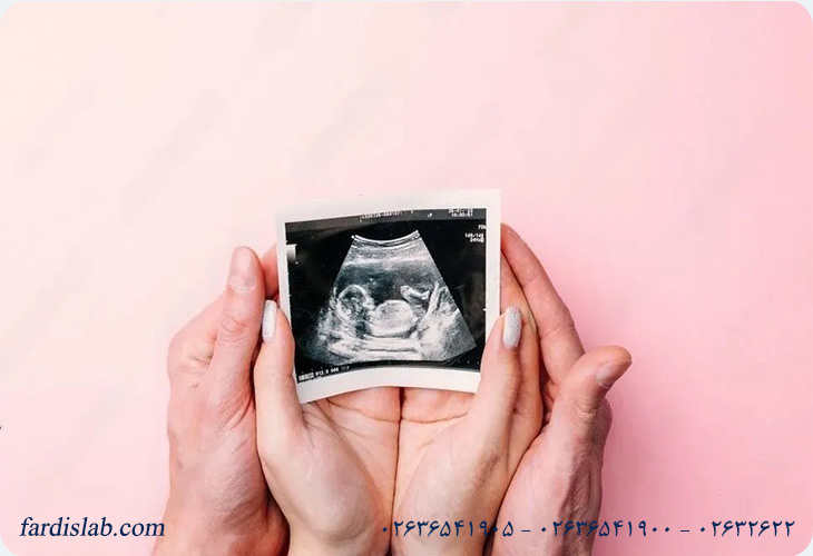 علت افزایش NT چیست