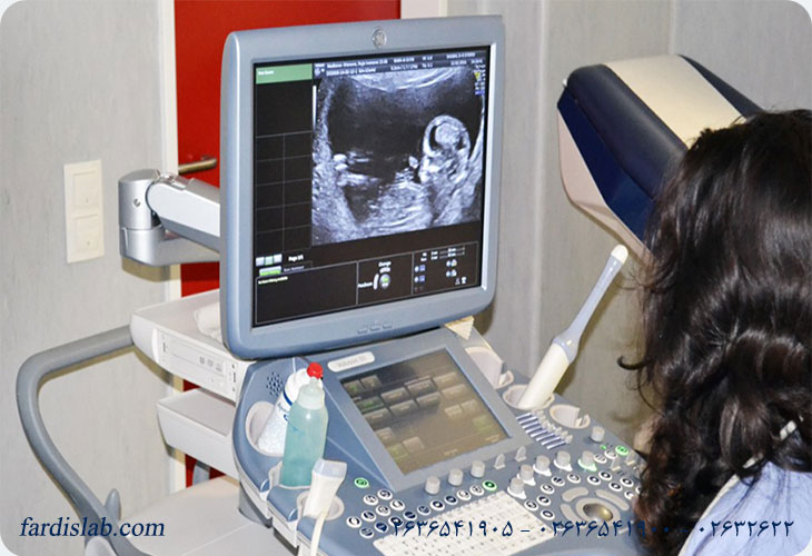 غربالگری سه‌ماهه اول شامل چه آزمایش‌هایی است؟