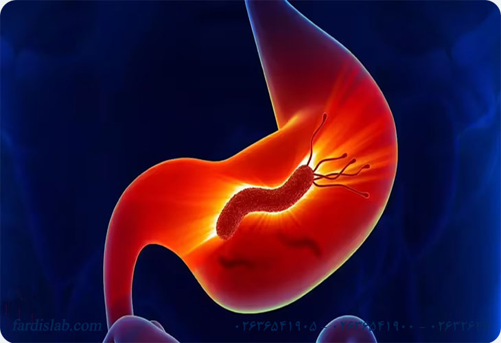 روش تشخیص هلیکوباکتر پیلوری