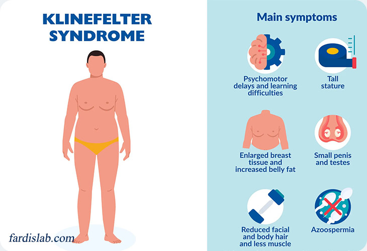 آیا سندرم کلاین‌فلتر قابل پیشگیری است؟