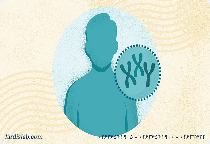 سندرم کلاین فلتر