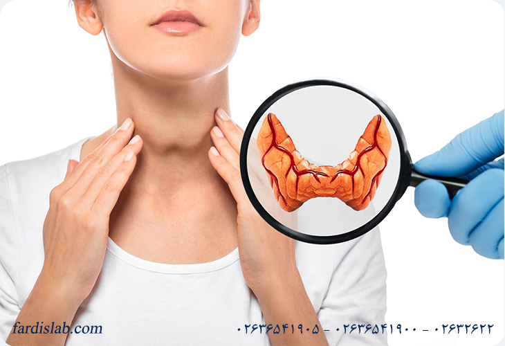 علائم پرکاری تیروئید در زنان