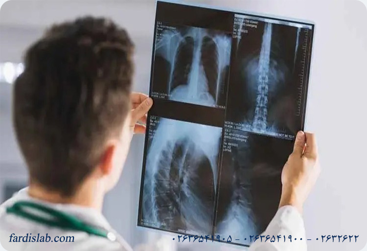 چه افرادی نیاز به آزمایش سنجش تراکم استخوان دارند؟