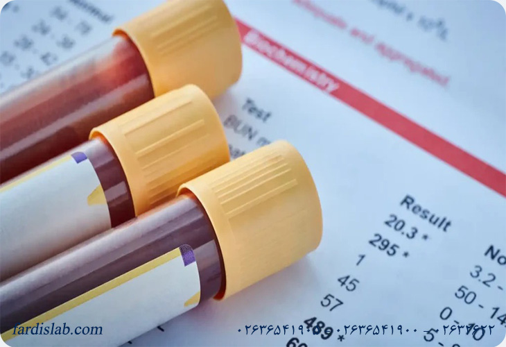 اهمیت آزمایش های هورمونی مردان