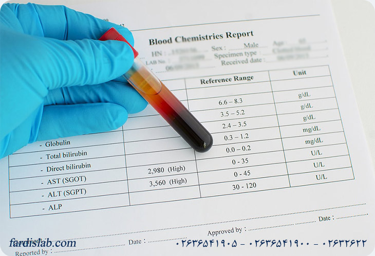 ALT و AST چیست و چه زمانی غیرطبیعی است؟ ALT و AST چیست و چه زمانی غیرطبیعی است؟