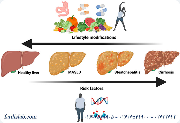 چه تغییراتی در سبک زندگی میتواند به بیماری کبد چرب کمک کند؟ چه تغییراتی در سبک زندگی میتواند به بیماری کبد چرب کمک کند؟