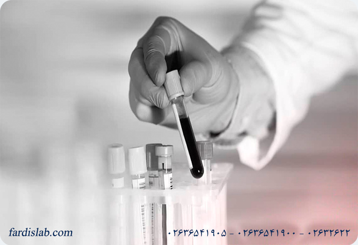 بهترین زمان برای انجام آزمایش bhcg؛ چه موقع دقیقتر است؟ بهترین زمان برای انجام آزمایش bhcg؛ چه موقع دقیقتر است؟