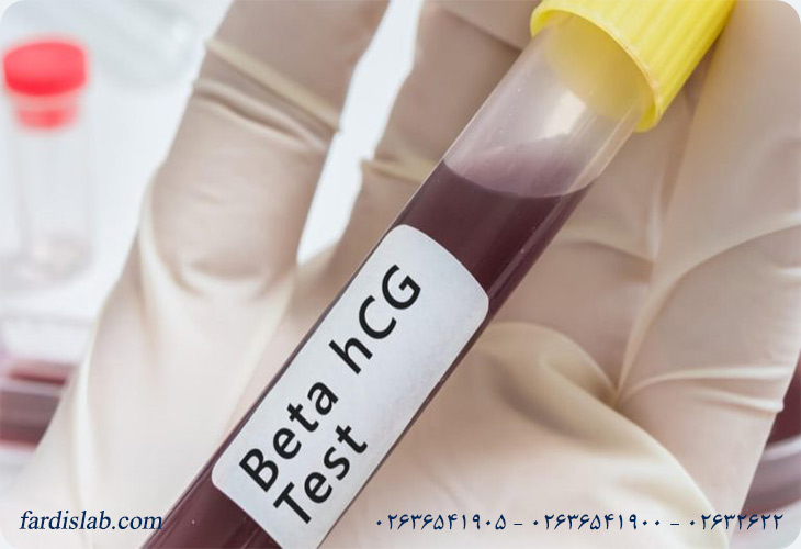 روش های اندازه گیری hCG 