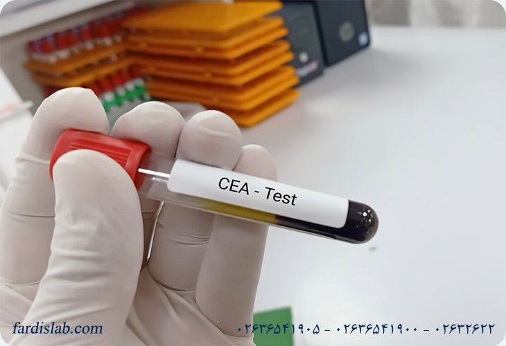 تفسیر نتیجه آزمایش CEA به زبان ساده